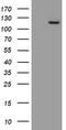 Myoneurin antibody, M12268, Boster Biological Technology, Western Blot image 