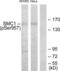 Structural Maintenance Of Chromosomes 1A antibody, LS-C199590, Lifespan Biosciences, Western Blot image 