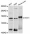 ArfGAP With RhoGAP Domain, Ankyrin Repeat And PH Domain 2 antibody, STJ114144, St John