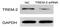 Triggering Receptor Expressed On Myeloid Cells 2 antibody, GTX53229, GeneTex, Western Blot image 