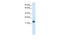 Cysteine And Glycine Rich Protein 3 antibody, 28-024, ProSci, Western Blot image 