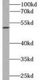 Adrenoceptor Alpha 1A antibody, FNab00177, FineTest, Western Blot image 