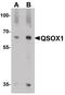 Quiescin Sulfhydryl Oxidase 1 antibody, PA5-38009, Invitrogen Antibodies, Western Blot image 
