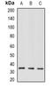 General Transcription Factor IIH Subunit 3 antibody, orb341249, Biorbyt, Western Blot image 