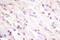 Checkpoint Kinase 2 antibody, LS-C176270, Lifespan Biosciences, Immunohistochemistry frozen image 