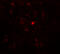RB Binding Protein 8, Endonuclease antibody, A02076-1, Boster Biological Technology, Immunofluorescence image 