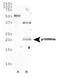 Cyclin-dependent kinase inhibitor 2A, isoform 3 antibody, NB200-106, Novus Biologicals, Western Blot image 