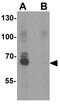 NADPH Oxidase 4 antibody, GTX31588, GeneTex, Western Blot image 