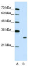 Muscleblind Like Splicing Regulator 1 antibody, TA344055, Origene, Western Blot image 