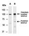 Lysine-specific demethylase 2A antibody, orb67175, Biorbyt, Western Blot image 