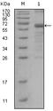 MutS Homolog 6 antibody, STJ98123, St John