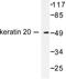 Keratin 20 antibody, LS-B10488, Lifespan Biosciences, Western Blot image 