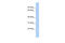 DEAD-Box Helicase 59 antibody, 25-362, ProSci, Western Blot image 