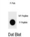 Cyclin Dependent Kinase Inhibitor 1B antibody, abx032273, Abbexa, Dot Blot image 