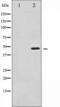 Synaptotagmin 1 antibody, TA325929, Origene, Western Blot image 