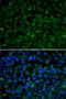 Glucose-6-Phosphate Isomerase antibody, LS-C748366, Lifespan Biosciences, Immunofluorescence image 