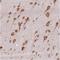 Hyaluronan Binding Protein 4 antibody, NBP2-30907, Novus Biologicals, Immunohistochemistry paraffin image 