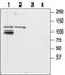 Glutamate Ionotropic Receptor Kainate Type Subunit 2 antibody, TA328828, Origene, Western Blot image 