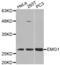 EMG1 N1-Specific Pseudouridine Methyltransferase antibody, abx003301, Abbexa, Western Blot image 