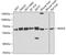 Jumonji Domain Containing 4 antibody, A16245-1, Boster Biological Technology, Western Blot image 