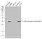 Ribosomal Protein S6 antibody, GTX133942, GeneTex, Western Blot image 