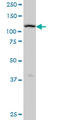 ADAM Metallopeptidase With Thrombospondin Type 1 Motif 17 antibody, LS-B4548, Lifespan Biosciences, Western Blot image 