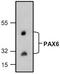 Paired Box 6 antibody, TA318938, Origene, Western Blot image 