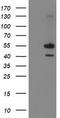 Phosphatidylinositol-5-Phosphate 4-Kinase Type 2 Alpha antibody, TA502369S, Origene, Western Blot image 