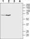 Solute Carrier Family 18 Member A1 antibody, PA5-77497, Invitrogen Antibodies, Western Blot image 