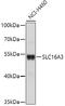 Monocarboxylate transporter 4 antibody, 16-097, ProSci, Western Blot image 