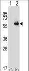 Aldehyde Dehydrogenase 4 Family Member A1 antibody, LS-C97488, Lifespan Biosciences, Western Blot image 