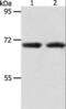 Acyl-CoA Thioesterase 11 antibody, LS-C404423, Lifespan Biosciences, Western Blot image 