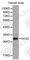 Regulator Of G Protein Signaling 2 antibody, A1795, ABclonal Technology, Western Blot image 