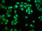 Fragile Histidine Triad Diadenosine Triphosphatase antibody, LS-C211983, Lifespan Biosciences, Immunofluorescence image 