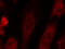 Eukaryotic Translation Initiation Factor 2 Subunit Alpha antibody, LS-C335983, Lifespan Biosciences, Immunofluorescence image 