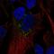 RAB5B, Member RAS Oncogene Family antibody, HPA068337, Atlas Antibodies, Immunofluorescence image 