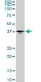Pentraxin-related protein PTX3 antibody, H00005806-M02, Novus Biologicals, Western Blot image 