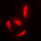 Histone Deacetylase 5 antibody, LS-C353225, Lifespan Biosciences, Immunofluorescence image 