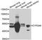 Cytochrome P450 Family 2 Subfamily A Member 6 antibody, TA332933, Origene, Western Blot image 