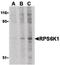 90 kDa ribosomal protein S6 kinase 1 antibody, PA5-20134, Invitrogen Antibodies, Western Blot image 