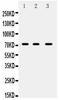 ATP Binding Cassette Subfamily G Member 5 antibody, PB9415, Boster Biological Technology, Western Blot image 