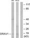 LTO1 Maturation Factor Of ABCE1 antibody, A30533, Boster Biological Technology, Western Blot image 