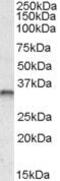 JunB Proto-Oncogene, AP-1 Transcription Factor Subunit antibody, PA5-19135, Invitrogen Antibodies, Western Blot image 