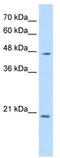 Paired Box 6 antibody, TA331135, Origene, Western Blot image 