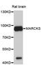 Myristoylated Alanine Rich Protein Kinase C Substrate antibody, A0936, ABclonal Technology, Western Blot image 