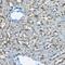 Perilipin 2 antibody, GTX54569, GeneTex, Immunohistochemistry paraffin image 