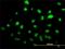 SUMO1 Activating Enzyme Subunit 1 antibody, H00010055-M01, Novus Biologicals, Immunofluorescence image 