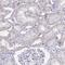 Zinc Finger Protein 182 antibody, NBP2-32480, Novus Biologicals, Immunohistochemistry paraffin image 