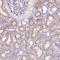 Matrix Metallopeptidase 11 antibody, NBP2-49575, Novus Biologicals, Immunohistochemistry frozen image 