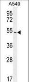 Arrestin Beta 1 antibody, LS-C156512, Lifespan Biosciences, Western Blot image 